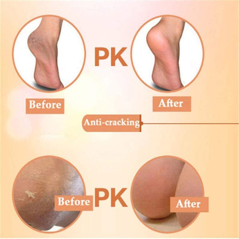 Heel Protector (1 Pair), Anti-slip Heel Cushion, Foot Heel Protector, Ankle Support Pad, Breathable Heel Pad, Heel Protector, Comfort Heel Protector