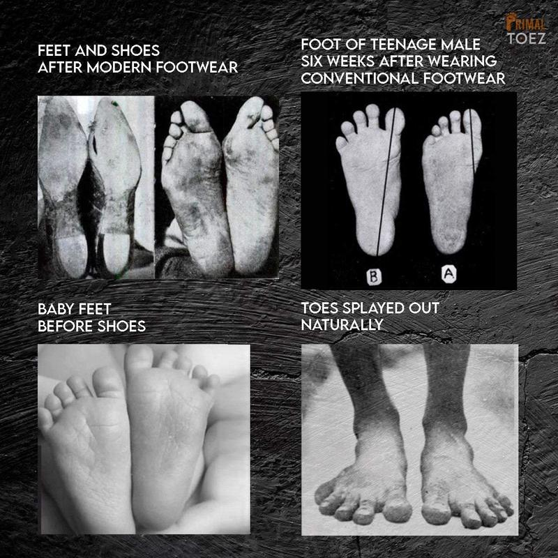 Primal Toez™ 'Walkabouts' - Active Toe Spacers